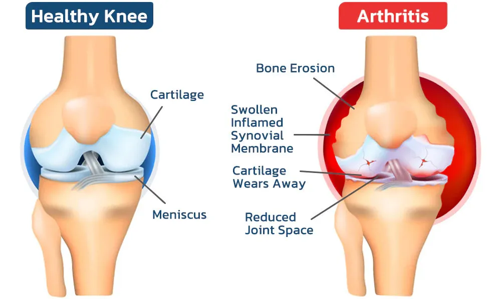 BeeTherapy Joint and Bone Therapy Cream - (Buy 1 get 2 Free)