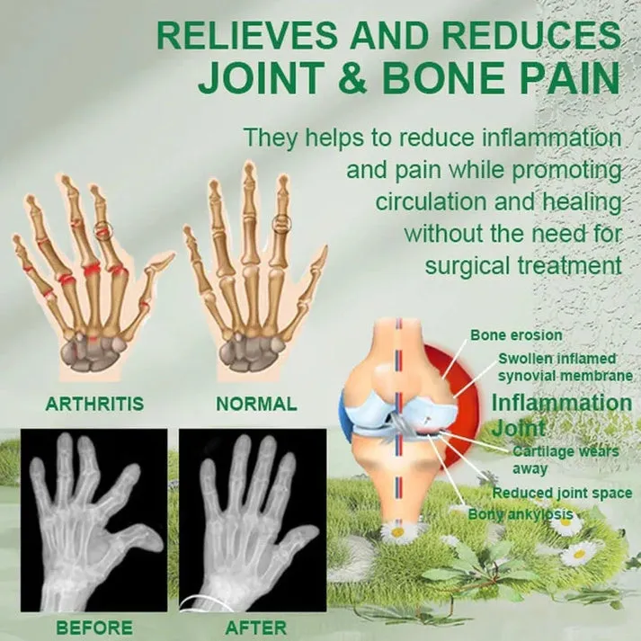 BeeTherapy Joint and Bone Therapy Cream - (Buy 1 get 2 Free)