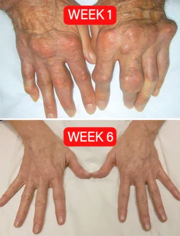 BeeTherapy Joint and Bone Therapy Cream - (Buy 1 get 2 Free)